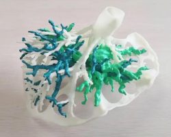 3D printing technology has entered the medical field strongly