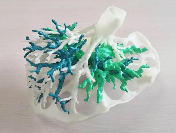 The Application of 3D Printing Technology in the Medical Field