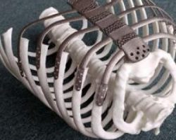 3D printed paper for cervical spine