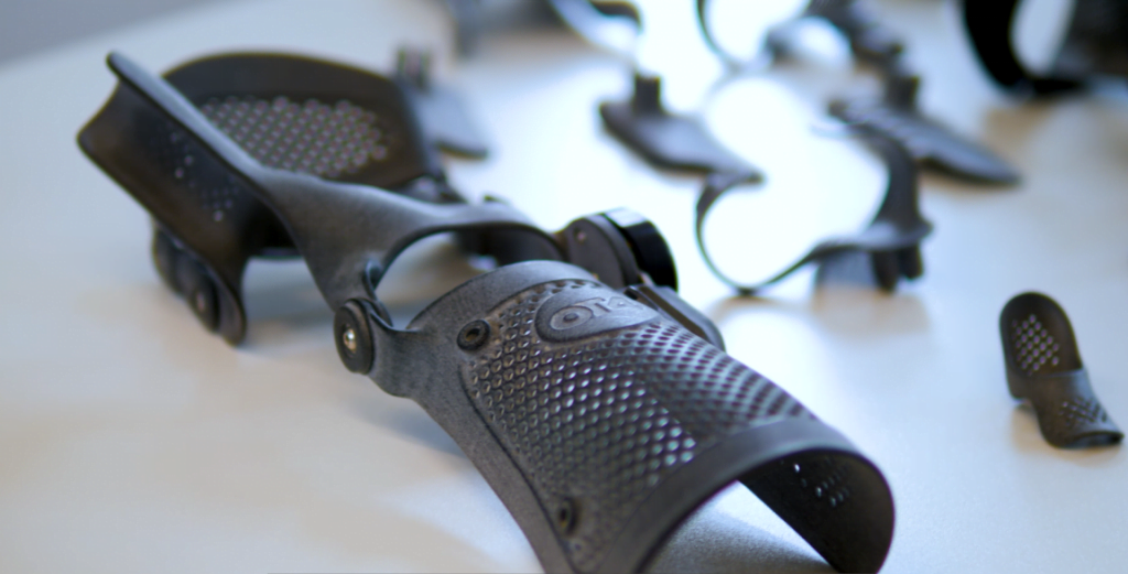 3D scanning and 3D printing technologies support orthopaedic brace customisation