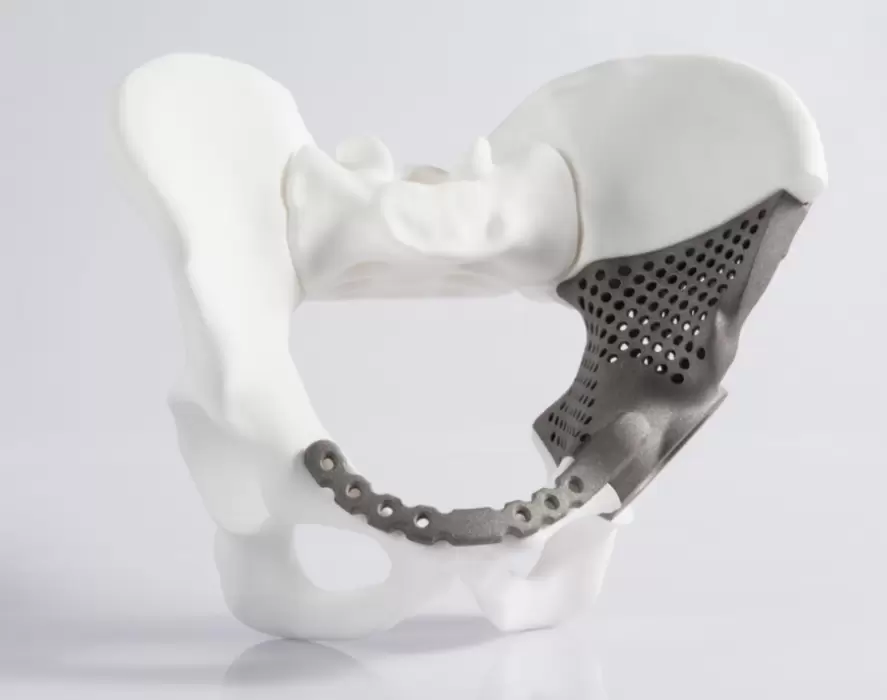 Orthopedic Additive Manufacturing: Benefits and Challenges